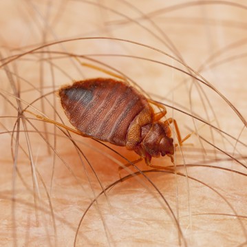 A bed bug crawling on a person's hair.