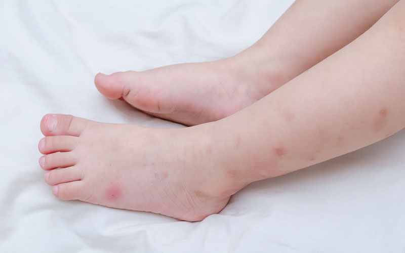 A child's feet on a white bed.