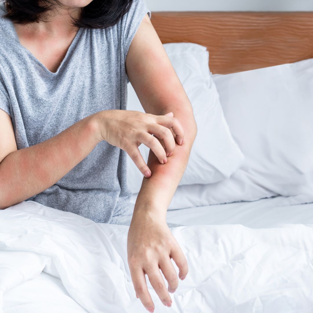 Woman scratching her arm in bed.